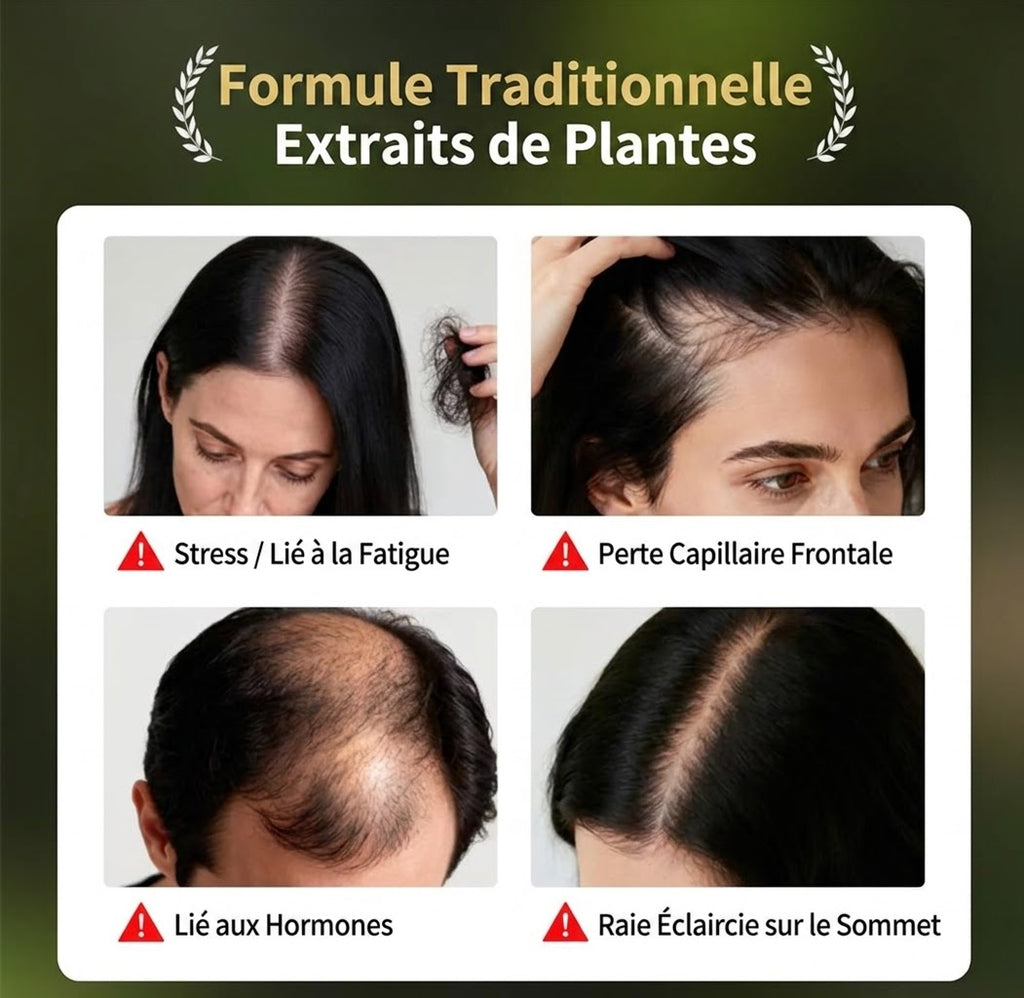 Kit de Soins Capillaires Usman – Huile, Spray & Savon – vue produit 11